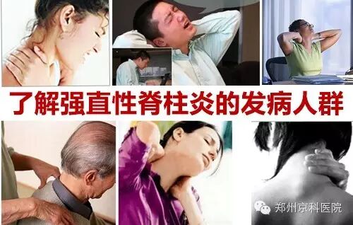 强直性脊柱炎症状.jpg